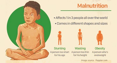 WHO Advices on Tackling Acute Malnutrition